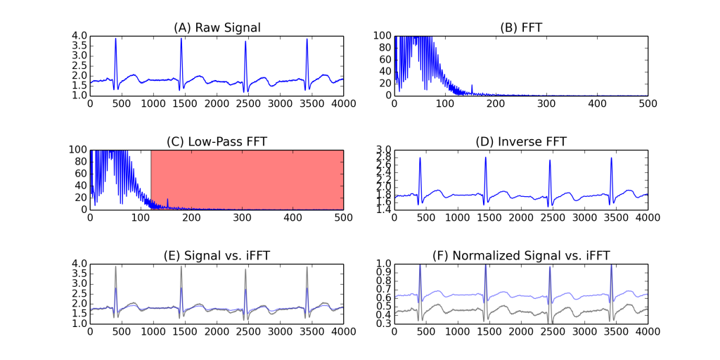 3670828227-ecg_noise_filter_example